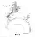 Fig. 06 - Medical device implantation and positioning system
