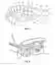 Fig. 04 - System and Method of Installing Dental Prostheses for Passively Influencing Tongue Position to Reduce Airway Obstruction