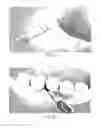 Fig. 08 - Interdental cleaner