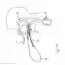 Fig. 11 - Suction stent, stent system, and method for sealing a leakage