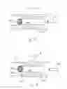 Fig. 13 - Suction stent, stent system, and method for sealing a leakage