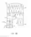 Fig. 23 - Debranching visceral stent graft and methods for use
