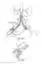Fig. 28 - Debranching visceral stent graft and methods for use