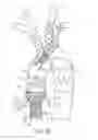 Fig. 33 - Debranching visceral stent graft and methods for use