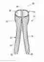 Fig. 01 - Bifurcated medical device for treating a target site and associated method