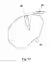 Fig. 13 - Implant placement systems and one-handed methods for tissue fixation using same