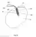 Fig. 20 - Implant placement systems and one-handed methods for tissue fixation using same