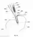 Fig. 27 - Implant placement systems and one-handed methods for tissue fixation using same