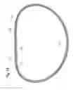 Fig. 09 - Methods for repairing mitral valves