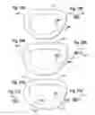 Fig. 13 - Methods for repairing mitral valves