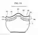 Fig. 07 - Cartilage prosthetic implant
