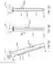 Fig. 03 - Total joint replacement infection control devices and methods
