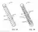 Fig. 04 - Total joint replacement infection control devices and methods