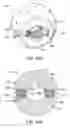 Fig. 28 - Total joint replacement infection control devices and methods