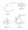 Fig. 05 - Systems and methods for providing a femoral component having a modular stem