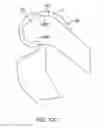Fig. 23 - Systems and methods for providing a femoral component having a modular stem