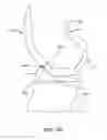 Fig. 29 - Systems and methods for providing a femoral component having a modular stem
