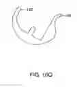 Fig. 40 - Systems and methods for providing a femoral component having a modular stem