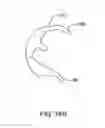 Fig. 41 - Systems and methods for providing a femoral component having a modular stem
