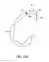 Fig. 44 - Systems and methods for providing a femoral component having a modular stem