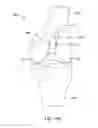 Fig. 53 - Systems and methods for providing a femoral component having a modular stem