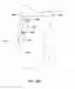 Fig. 72 - Systems and methods for providing a femoral component having a modular stem