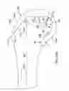 Fig. 74 - Systems and methods for providing a femoral component having a modular stem