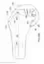 Fig. 75 - Systems and methods for providing a femoral component having a modular stem