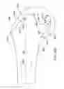 Fig. 76 - Systems and methods for providing a femoral component having a modular stem
