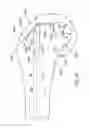 Fig. 83 - Systems and methods for providing a femoral component having a modular stem