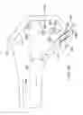 Fig. 87 - Systems and methods for providing a femoral component having a modular stem