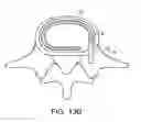 Fig. 22 - In-situ formed intervertebral fusion device and method