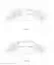 Fig. 06 - Glaucoma drainage implant