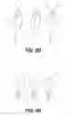 Fig. 06 - ORAL DRUG DELIVERY DEVICE AND METHODS OF USING THE SAME