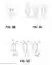 Fig. 08 - ORAL DRUG DELIVERY DEVICE AND METHODS OF USING THE SAME