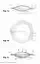 Fig. 02 - Packaging article comprising an envelope and an anhydrous dye composition comprising an oxidation dye, use of the same and process for dyeing keratin fibres