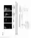Fig. 22 - METHOD AND COMPOSITION FOR IMPROVING SKIN CONDITIONS COMPRISING HUMAN PLACENTAL LACTOGEN AS AN ACTIVE INGREDIENT