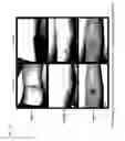 Fig. 35 - METHOD AND COMPOSITION FOR IMPROVING SKIN CONDITIONS COMPRISING HUMAN PLACENTAL LACTOGEN AS AN ACTIVE INGREDIENT