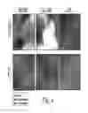 Fig. 05 - Cancer cell targeting using nanoparticles