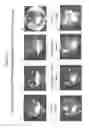 Fig. 03 - Method for Cancer Therapy Based on Co-Administration of a Parvovirus and a Cytokine