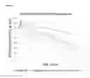 Fig. 02 - Method for improving the stability of purified factor VIII after reconstitution