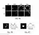Fig. 09 - Systems and methods for treatment of disease via application of mechanical force by controlled rotation of nanoparticles inside cells