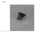 Fig. 02 - Targeting microbubbles