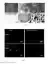 Fig. 16 - Nanoparticle Composition for Use in Targeting Cancer Stem Cells and Method for Treatment of Cancer