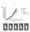 Fig. 06 - METHODS AND SYSTEMS FOR TREATING TUMORS