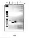 Fig. 02 - Co-expression of magnetotactic bacterial genes and genes encoding iron handling proteins in cells