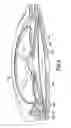 Fig. 05 - Patch-like infusion device