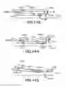 Fig. 127 - Patch-like infusion device