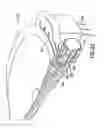 Fig. 23 - Patch-like infusion device