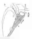 Fig. 24 - Patch-like infusion device